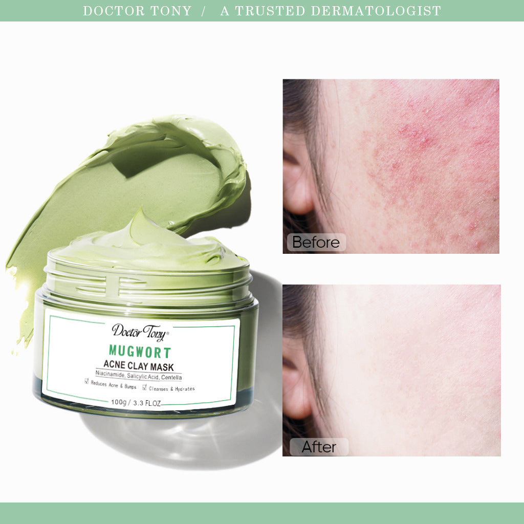 Anti-Acne Mud Clay Mask